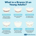 Braces Types for 18-Year-Olds