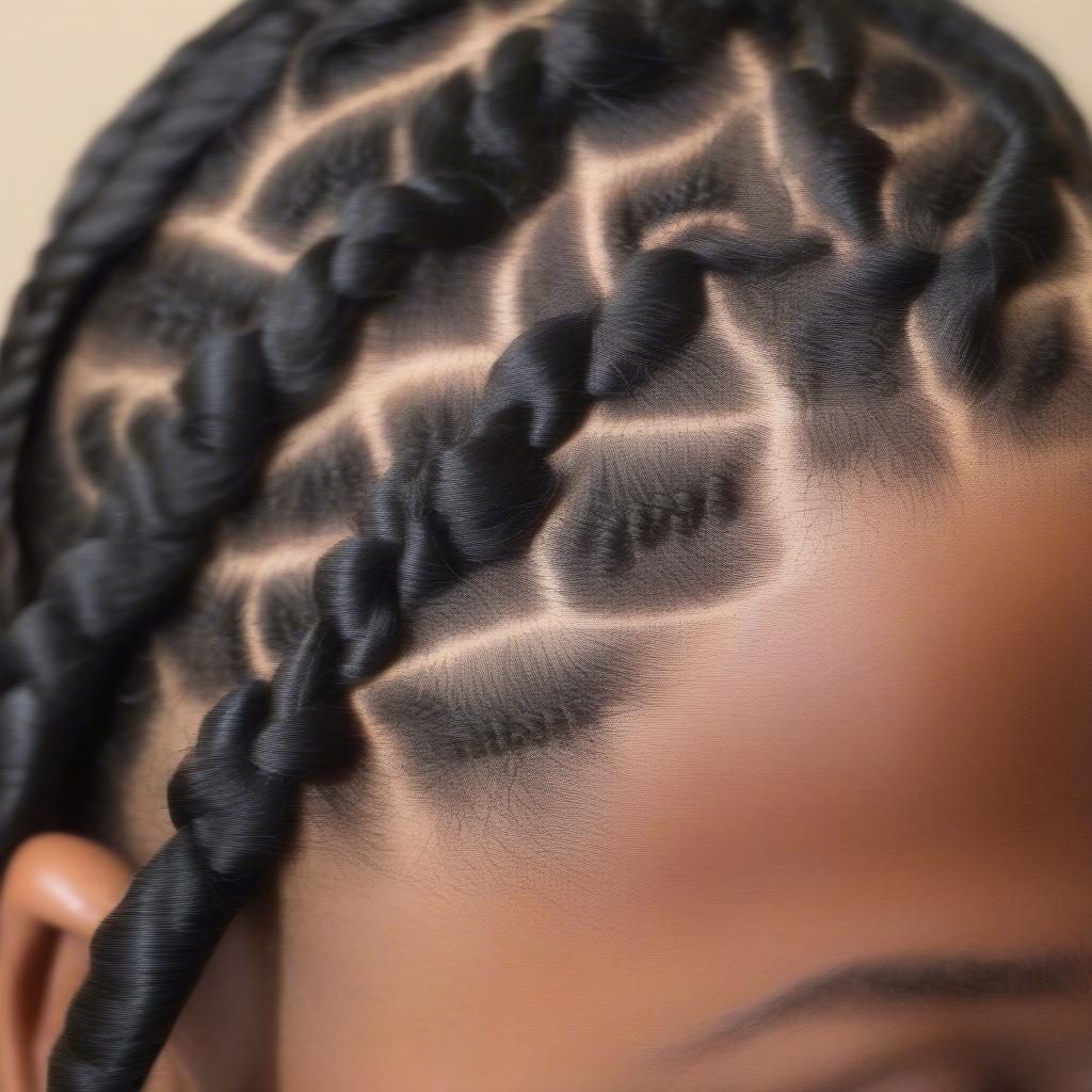 Traction Alopecia After Braids