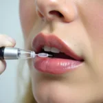 Hyaluronic acid pen filler being applied to lips