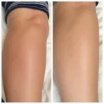 Kora Organics Self Tanner Results