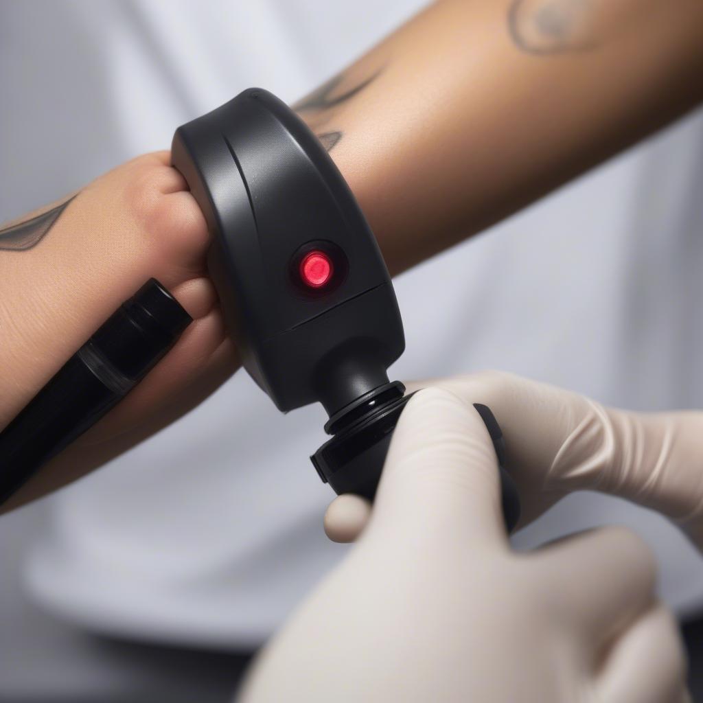 Laser Tattoo Removal Process on Wrist