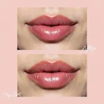 City Lips Before and After Results