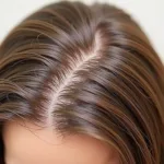 Healthy Scalp and Hair