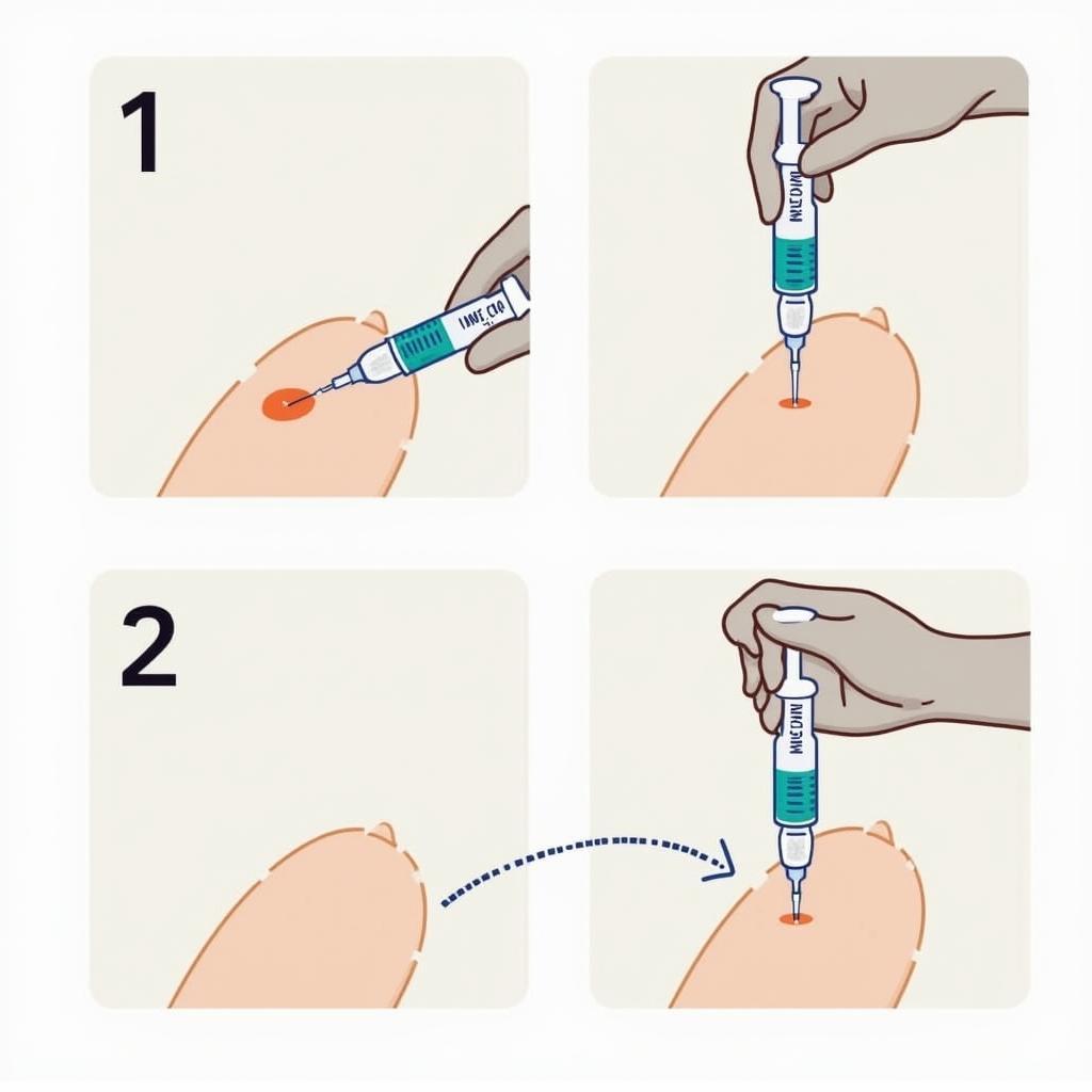 Rejuran Treatment Process