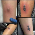 Skin Tone Tattoo Examples