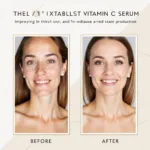 Benefits of Trifecta Vitamin C Serum