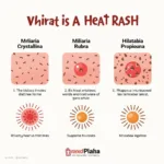 Types of Doc Band Heat Rash